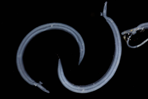 Schistosoma jest rodzajem trematod, powszechnie znanym jako flukes krwi pod mikroskopem edukacji w laboratorium. - Zdjęcie, obraz