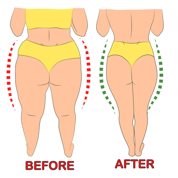Cuerpo de la mujer antes y después de la dieta o entrenamiento - Vector, Imagen