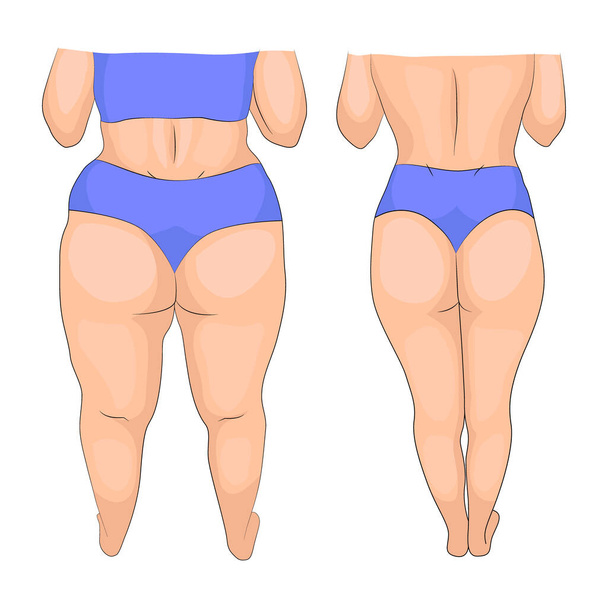 Mujer en ropa interior azul antes y después del entrenamiento, dieta o liposucción  - Vector, imagen