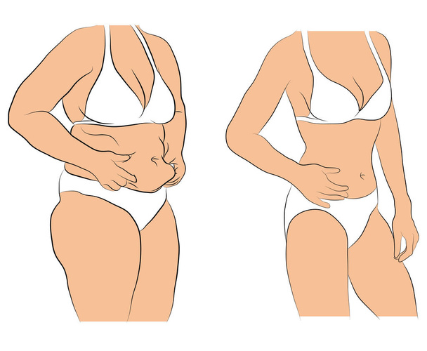 Woman with fat belly comparing with slim woman - Vector, Image