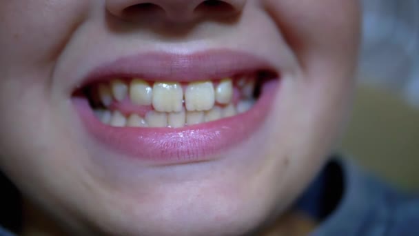 Happy smile on Boys face. Close-up of babys lips and mouth. Child Shows Teeth - Footage, Video