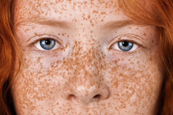 Portrét rudovlasé dívky se spoustou pih na obličeji a modrýma očima hledící do kamery - Fotografie, Obrázek