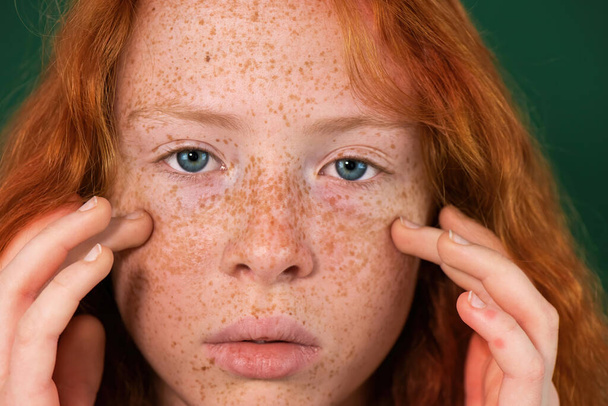 Ritratto di una ragazza dai capelli rossi che tocca un viso pieno di lentiggini, occhi azzurri che guardano nella macchina fotografica, sfondo verde - Foto, immagini