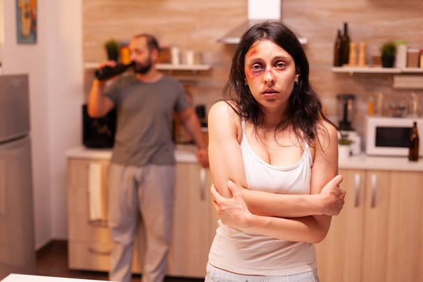 Vítima de violência doméstica - Foto, Imagem