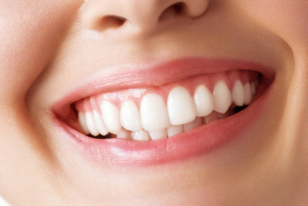 Совершенно здоровые зубы улыбаются молодой женщине. Отбеливание зубов. Стоматологическая помощь, стоматология. - Фото, изображение