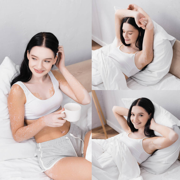 collage of happy woman with vitiligo smiling and holding cup of tea in bed - Fotografie, Obrázek