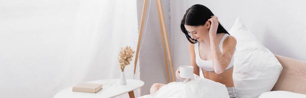 lächelnde Frau mit Vitiligo, die eine Tasse Kaffee hält, während sie Haare im Bett fixiert, Banner - Foto, Bild