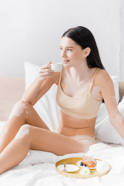 mladá šťastná žena s vitiligo podržet šálek u snídaně tác na posteli - Fotografie, Obrázek