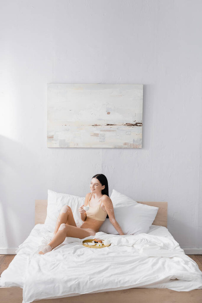 joven alegre mujer con vitiligo celebración taza cerca de bandeja de desayuno en la cama - Foto, imagen