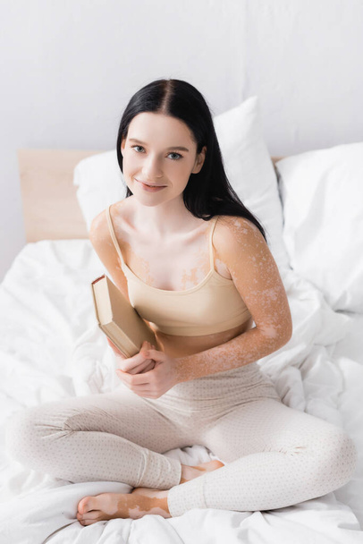 happy woman with vitiligo holding book and looking at camera in bedroom  - 写真・画像