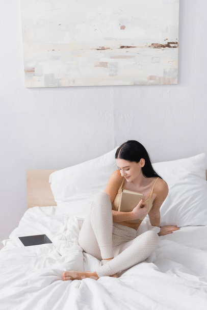 vitiligoを持つ女性は本を保持し、ベッドルームで空白の画面とデジタルタブレットの近くに座って  - 写真・画像