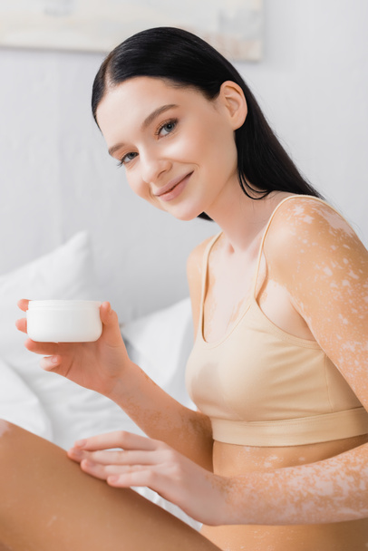 happy woman with vitiligo sitting on bed and holding container with cosmetic cream  - 写真・画像