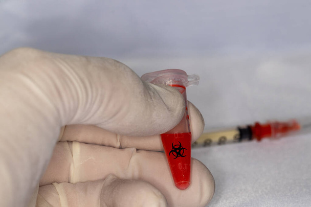 Образец коронавируса крови в лабораторном флаконе, помеченном знаком биологической опасности - Фото, изображение