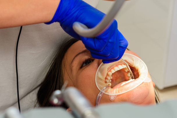Na het reinigen van de tanden van tandsteen spoelt de tandarts ze af met water, alleen met steriele instrumenten.2020 - Foto, afbeelding