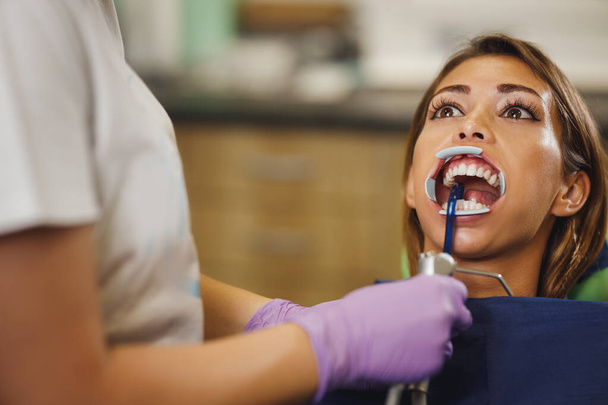 Η φωτογραφία μιας όμορφης νεαρής γυναίκας είναι στον οδοντίατρο. Κάθεται στην καρέκλα του οδοντίατρου και ο οδοντίατρος ετοιμάζεται να βάλει σιδεράκια στα δόντια της βάζοντας αισθητικές αυτο-ευθυγραμμισμένες γλωσσικές κλειδαριές. - Φωτογραφία, εικόνα