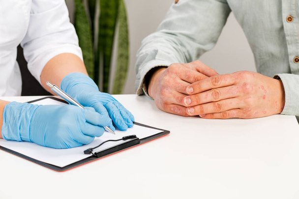 手袋をはめた皮膚科医が病気の患者の皮膚を検査し、観察を記録します。皮膚疾患アレルギー、乾癬、湿疹、皮膚炎の検査と診断. - 写真・画像
