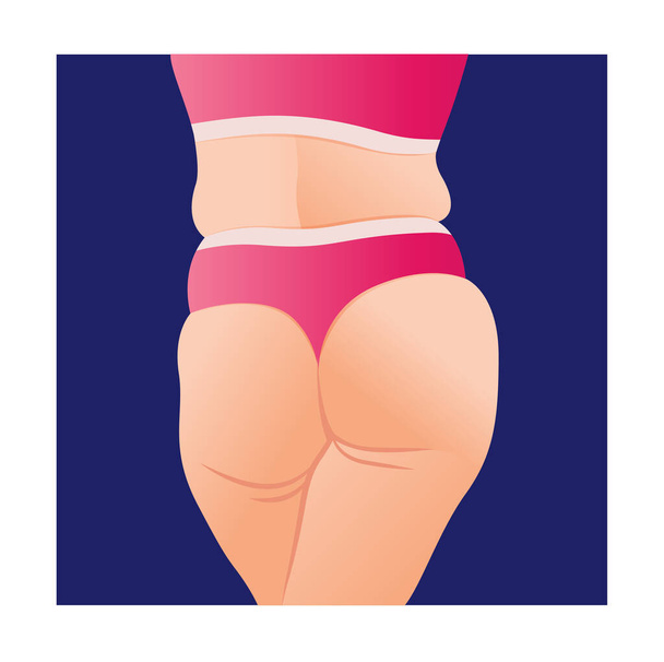 overweight female body, fat woman with cellulitis on buttocks. butt icon for mobile apps, fat body, vector illustration. - Vector, imagen