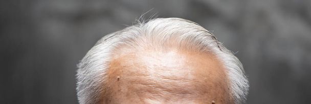 Азиатский мужчина старшего возраста с седыми волосами, лысиной старости, проблема выпадения волос - Фото, изображение