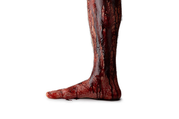 Sangramento perna humana isolada no fundo branco. - Foto, Imagem