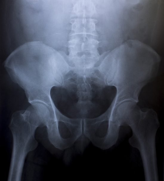 rentgenový obraz lidského hrudníku pro lékařskou diagnostiku - Fotografie, Obrázek