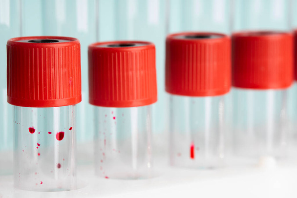 Tubos de ensayo de vidrio de laboratorio macro con gota de sangre sobre fondo azul - Foto, Imagen