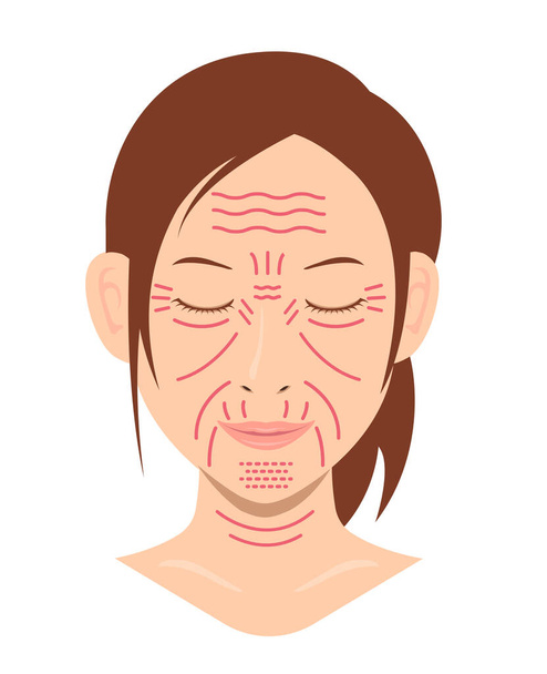 Arrugas faciales (cara femenina) vector ilustración / sin texto - Vector, Imagen