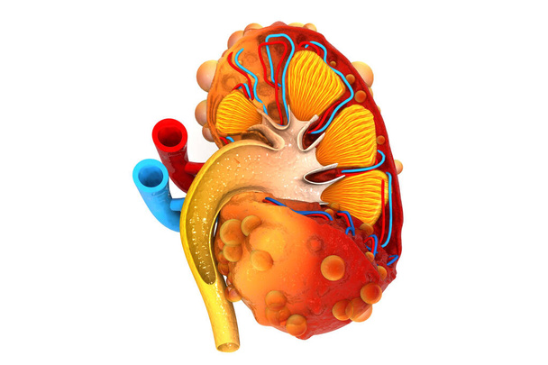 Nierenerkrankungen. Nierenquerschnitt. 3D-Illustration - Foto, Bild