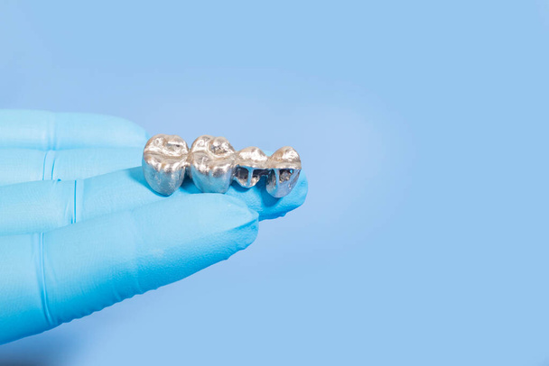 Iluminación estudio. hombre con guantes azules sostiene una corona de implante para los dientes. Primer plano - Foto, Imagen