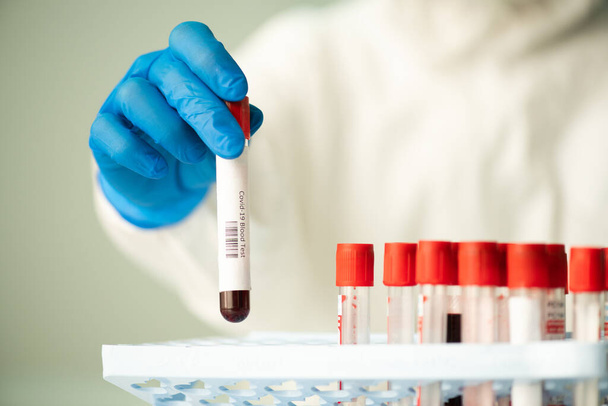 Перчаточная рука современного лаборанта в защитном комбинезоне, помещающая маленькую фляжку с образцом крови в клетку другими ковид19 тестами - Фото, изображение