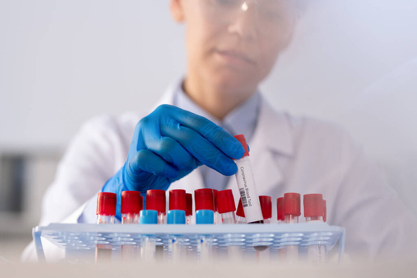 Mão enluvada de jovem trabalhadora de laboratório em whitecoat colocando pequeno frasco com teste de sangue coronavírus ao lado de outras amostras no trabalho - Foto, Imagem