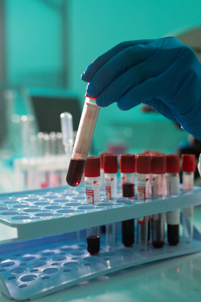 Handschuh des Forschers oder Laborarbeiters, der kleine Fläschchen mit Blutprobe zusammen mit anderen Covid19-Tests in die Zelle gibt - Foto, Bild