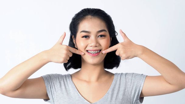 Азиатский подросток с брекетами и улыбкой в камеру, чтобы показать стоматологические ортодонтические зубы, которые включают в себя профессиональные металлические проволоки от ортодонта. студия выстрелил белый фон. - Фото, изображение