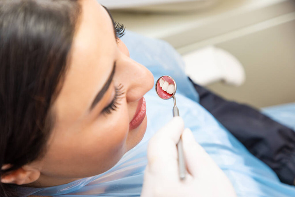 口鏡で歯を検査された若い女性のクローズアップ - 写真・画像