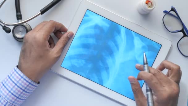El médico masculino lleva a cabo el análisis de la fotografía de rayos X en la tableta digital primer plano - Imágenes, Vídeo