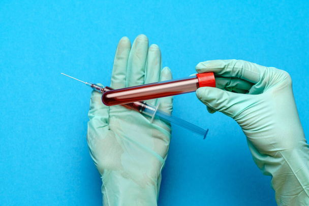 lab technician assistant or doctor holding a blood sample in test tube - Fotoğraf, Görsel