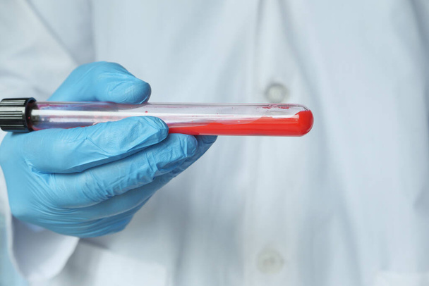 técnico de laboratorio mano sosteniendo tubo de análisis de sangre  - Foto, imagen