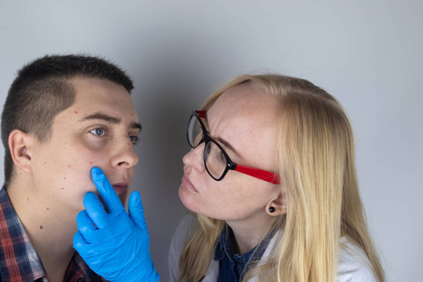 Egy allergológus vagy bőrgyógyász megvizsgálja a vörös foltokat egy férfi arcán. A hím kiütéstől, csalánkiütéstől és viszketéstől szenved. Ételallergia, rovarcsípés, kanyaró vagy bárányhimlő. Kiütés mérése vonalzóval - Fotó, kép