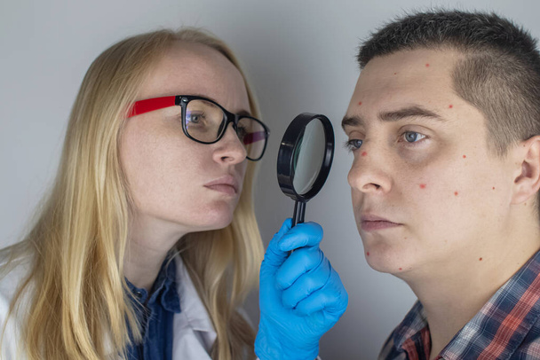 Primer plano del acné. Un hombre está siendo examinado por un médico. Dermatólogo examina la piel a través de una lupa, una lupa - Foto, Imagen