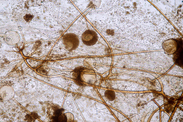  Характеристики Rhizopus - род распространенных сапрофилактических грибов на слайде под микроскопом для образования. - Фото, изображение