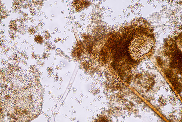  Χαρακτηριστικά του Rhizopus είναι ένα γένος κοινών σαπροφυτικών μυκήτων στο Slide κάτω από το μικροσκόπιο για την εκπαίδευση. - Φωτογραφία, εικόνα