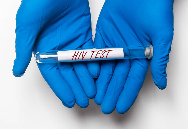 Test tubes with HIV test result of blood analysis in doctor hand. - Φωτογραφία, εικόνα