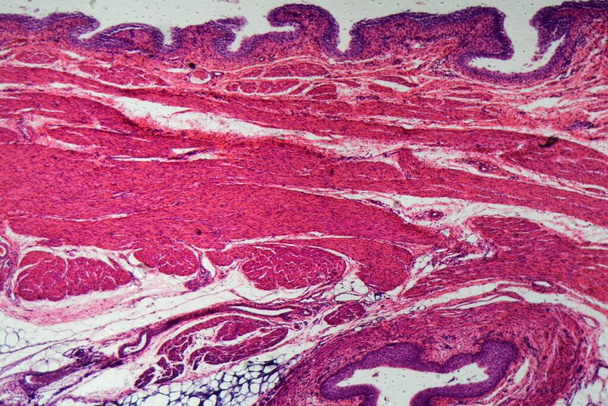 Células del epitelio de transición humano bajo el microscopio.  - Foto, Imagen