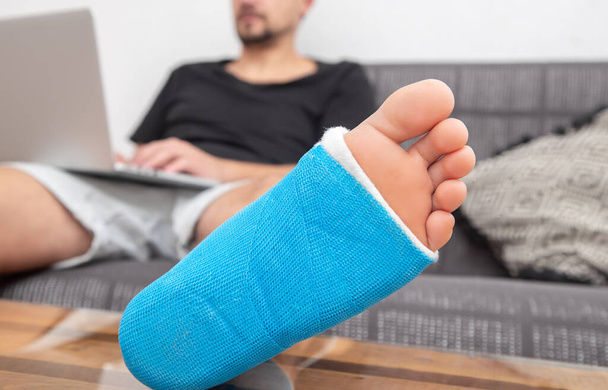 Muž se zlomenou nohou v obsazení pracuje na notebooku na gauči doma. - Fotografie, Obrázek