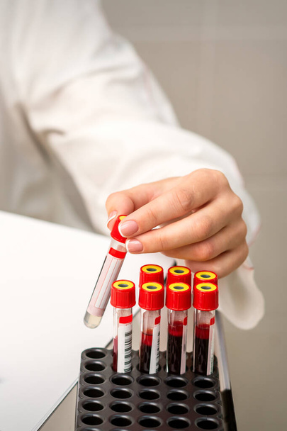 Mano del técnico de laboratorio o enfermera toma tubo de análisis de sangre vacío del estante en el laboratorio de investigación - Foto, imagen