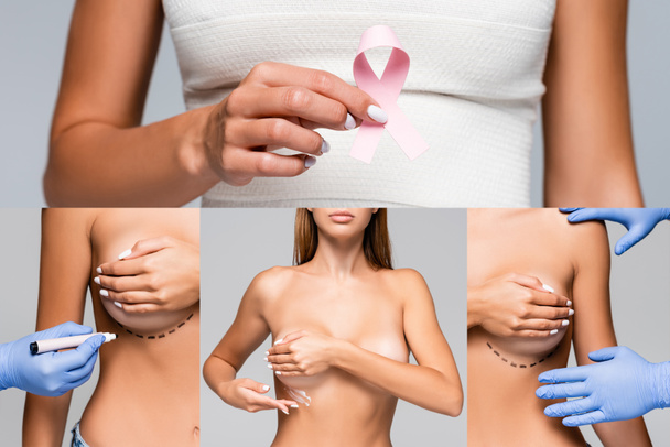 Collage de femme nue avec des marques sur le sein et bandage élastique tenant ruban de sensibilisation au cancer du sein et l'application de crème cosmétique près du médecin isolé sur gris  - Photo, image