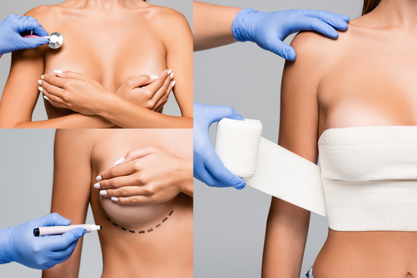 Collage de médico sosteniendo marcador, estetoscopio y vendaje elástico cerca del pecho de mujer desnuda aislada en gris  - Foto, imagen