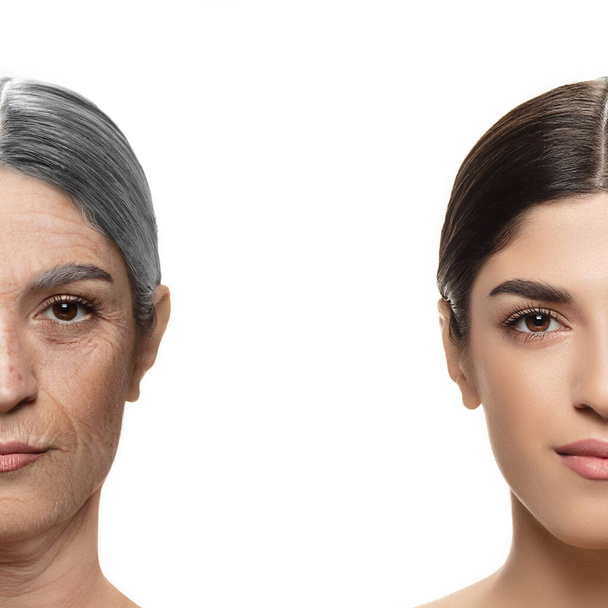 Comparison. Portrait of beautiful woman with problem and clean skin, aging and youth concept, beauty treatment and lifting. - Foto, imagen