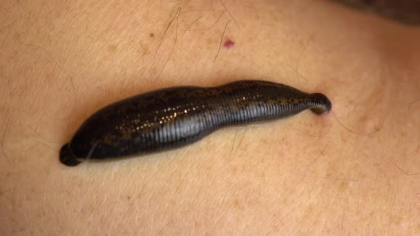 Medical leech on the human body drink blood. Treatment with leeches. Macro video. - Footage, Video