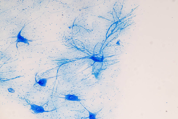Образование спинной мозг и двигательный нейрон под микроскопом в лаборатории. - Фото, изображение