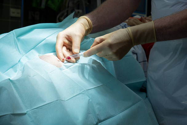 un médico realiza una punción de rodilla en un quirófano con una cánula y una jeringa - Foto, Imagen